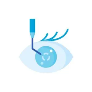Cataract Master